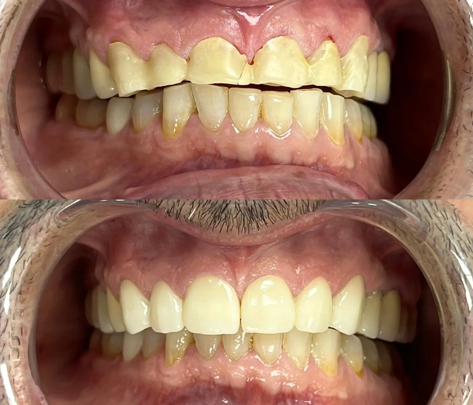 Caz clinic Sherman Dent — imaginea 1