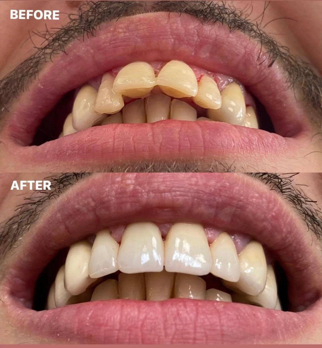 Caz clinic Sherman Dent — imaginea 10