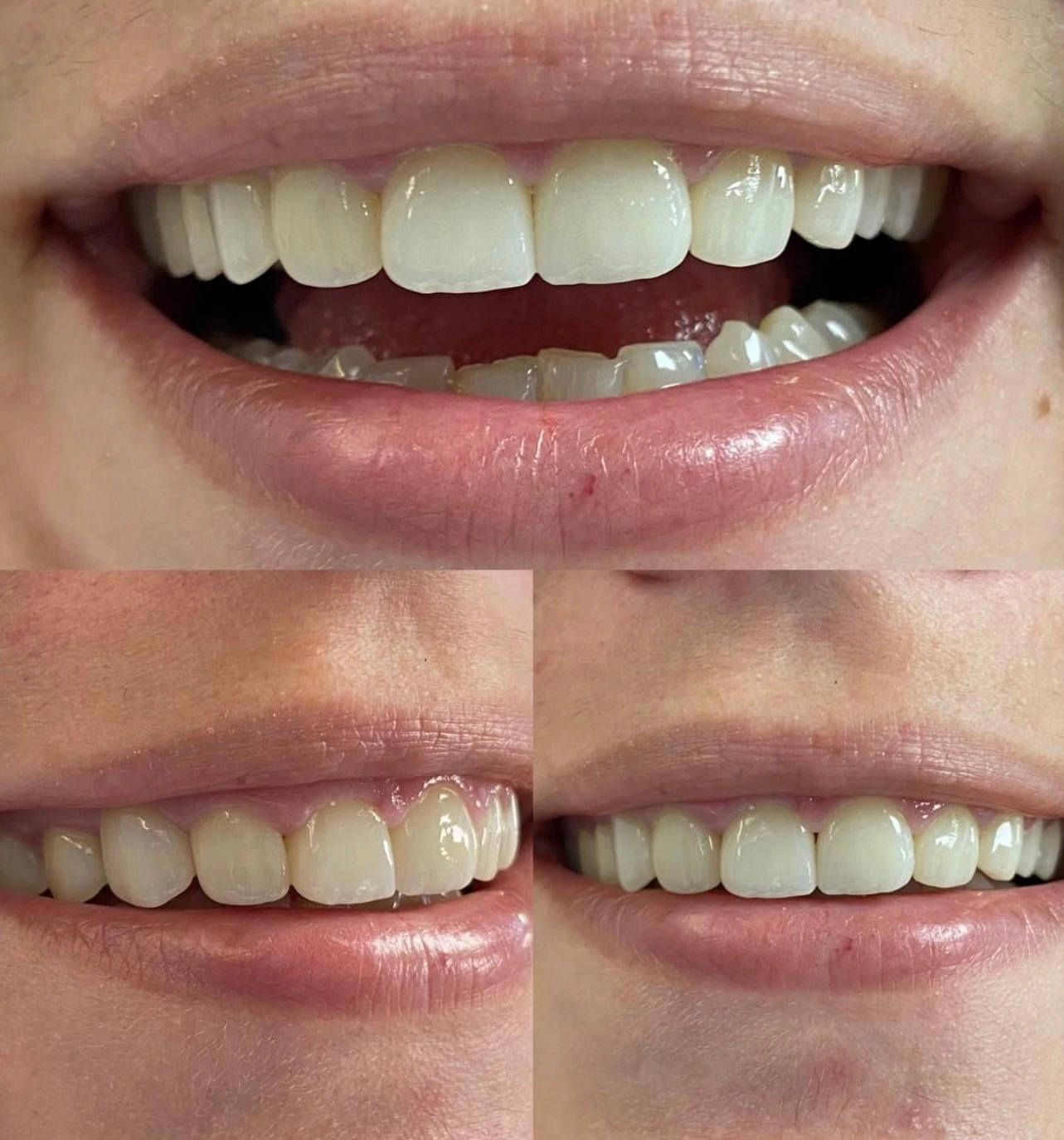 Caz clinic Sherman Dent — imaginea 11