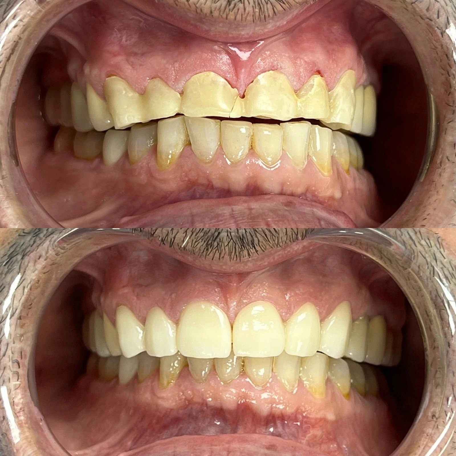 Caz clinic Sherman Dent — imaginea 13