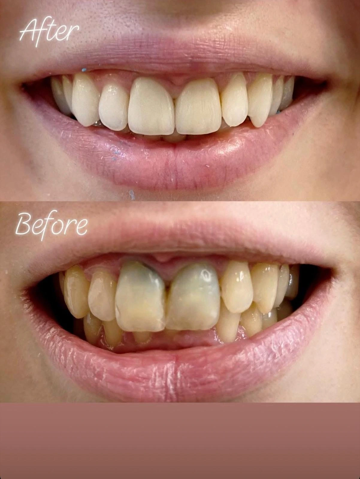 Caz clinic Sherman Dent — imaginea 15