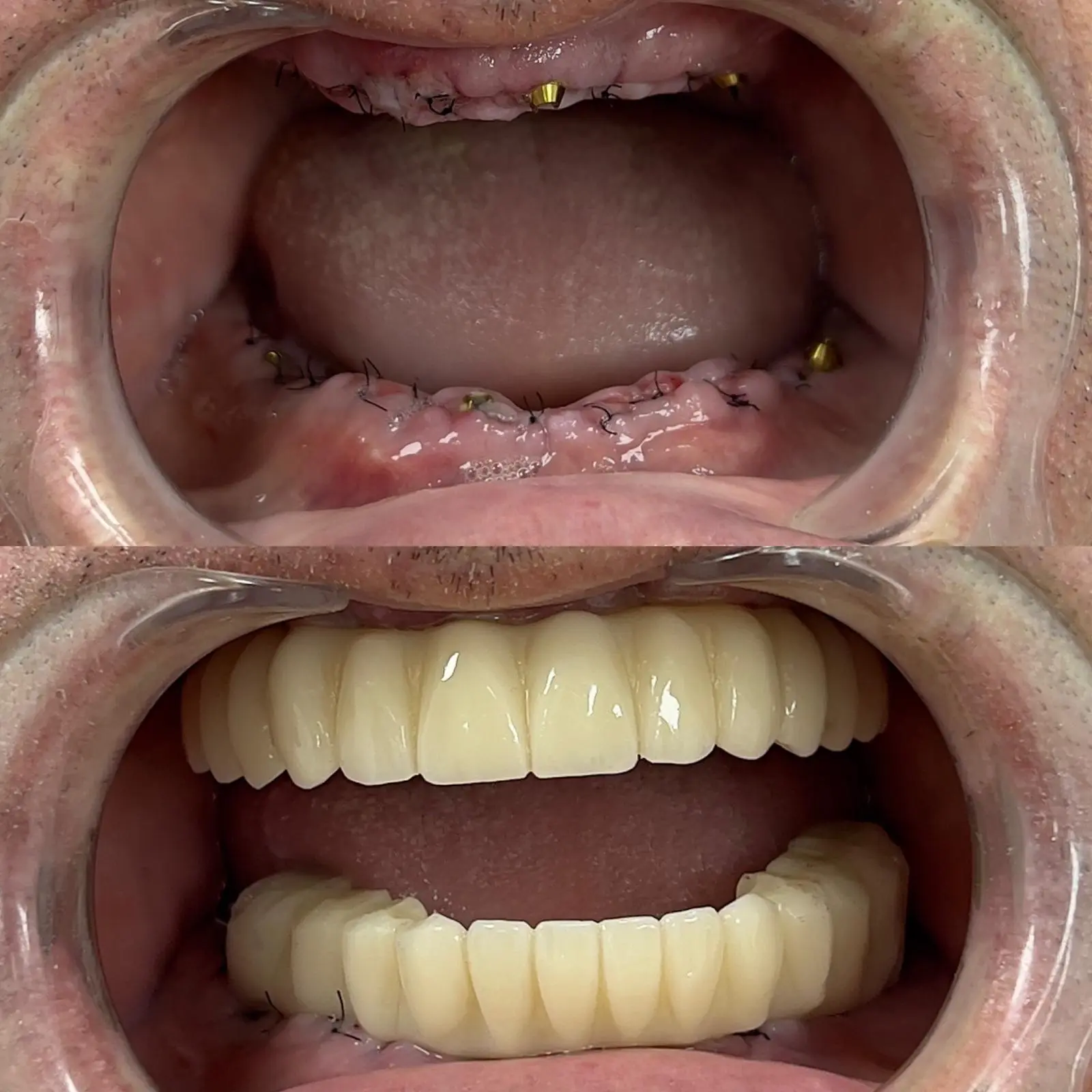 Caz clinic Sherman Dent — imaginea 5