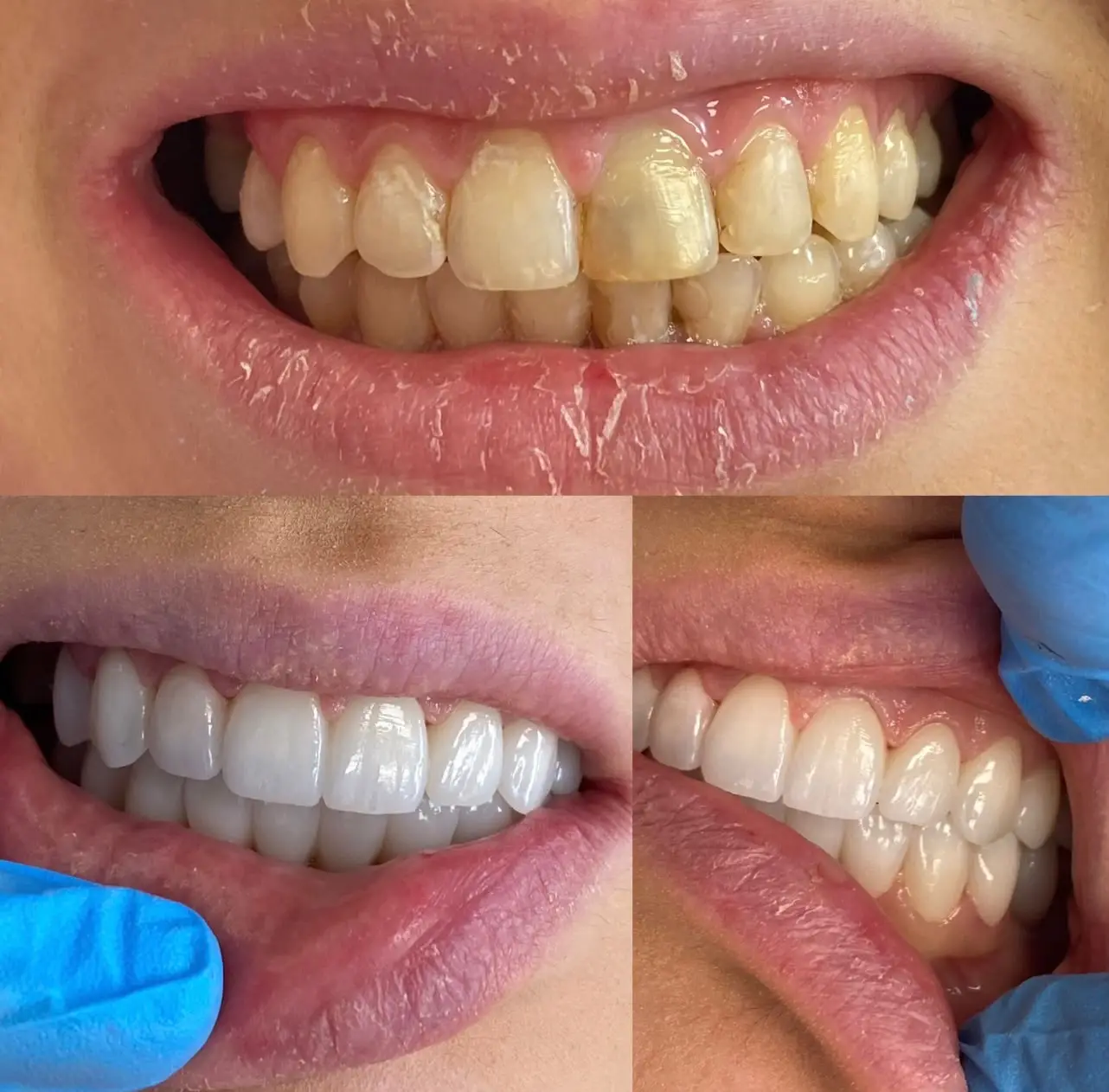 Caz clinic Sherman Dent — imaginea 2