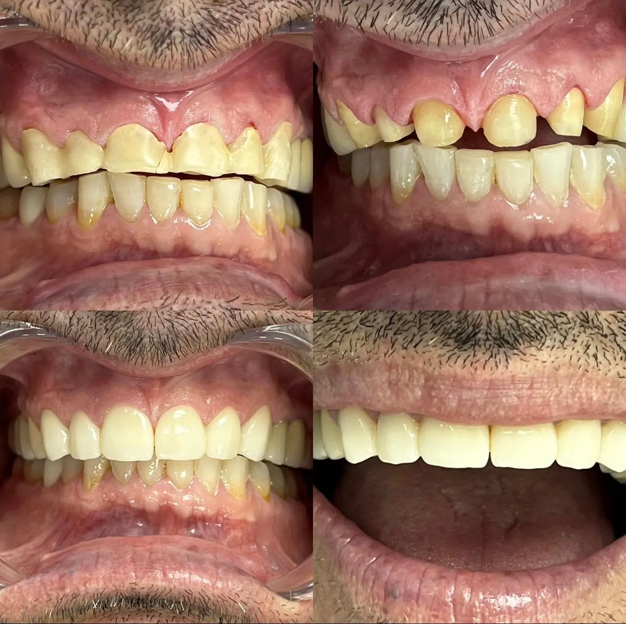 Caz clinic Sherman Dent — imaginea 3