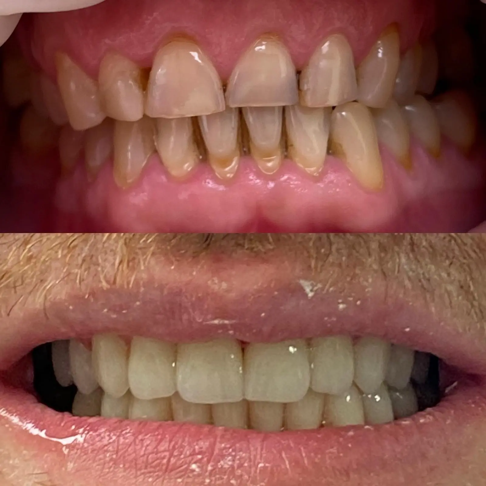 Caz clinic Sherman Dent — imaginea 4
