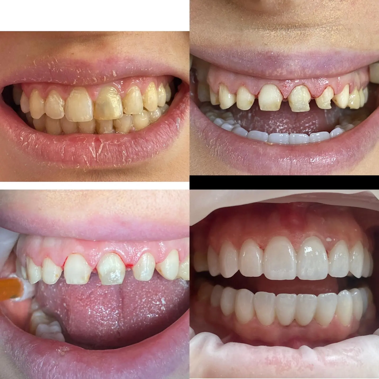 Caz clinic Sherman Dent — imaginea 6