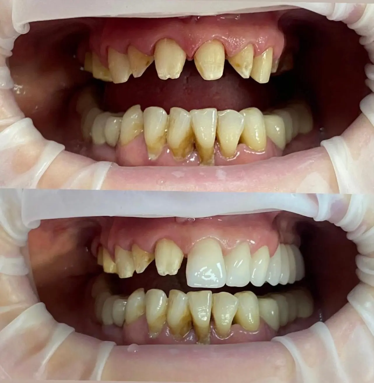 Caz clinic Sherman Dent — imaginea 7