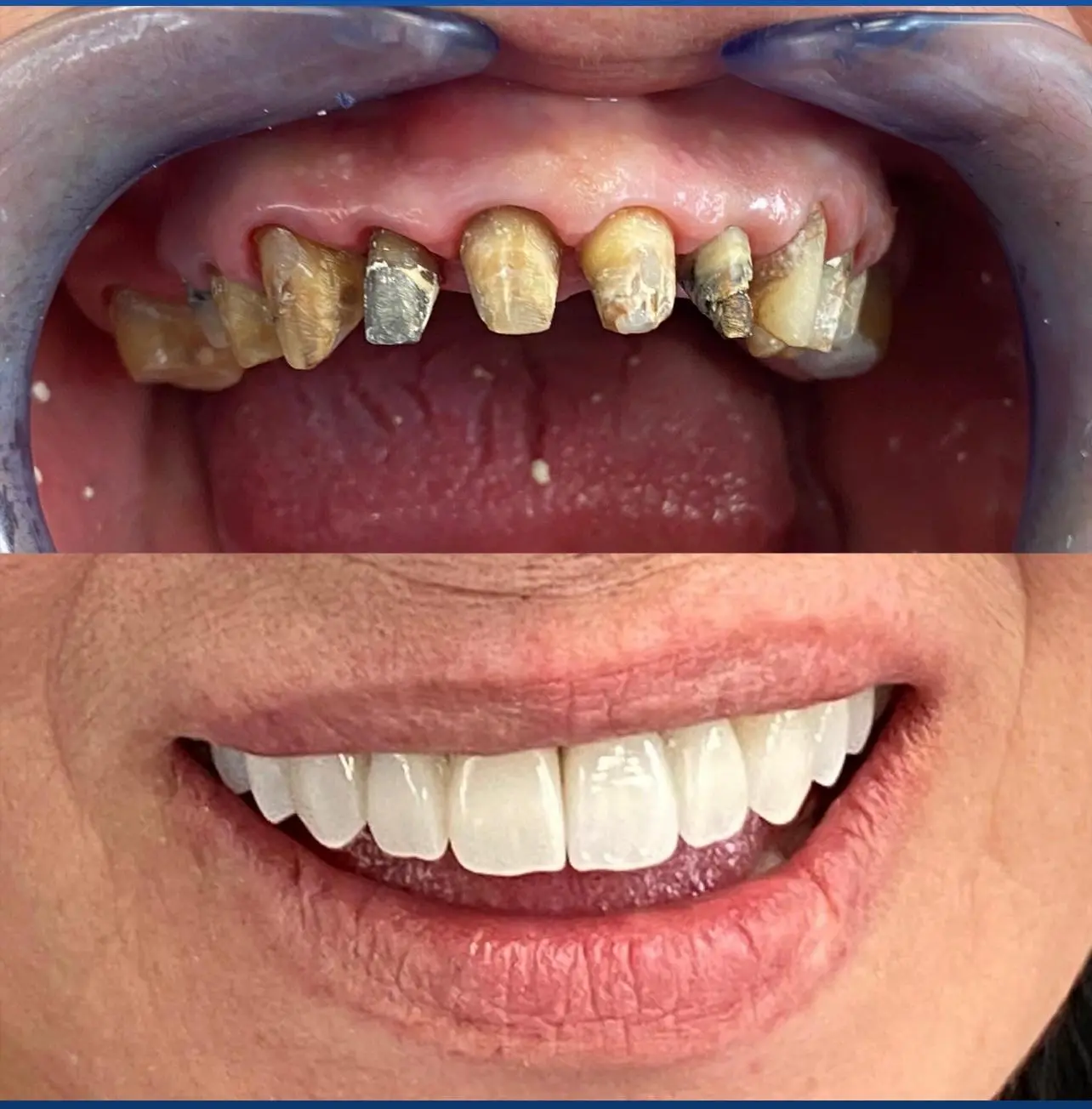Caz clinic Sherman Dent — imaginea 8