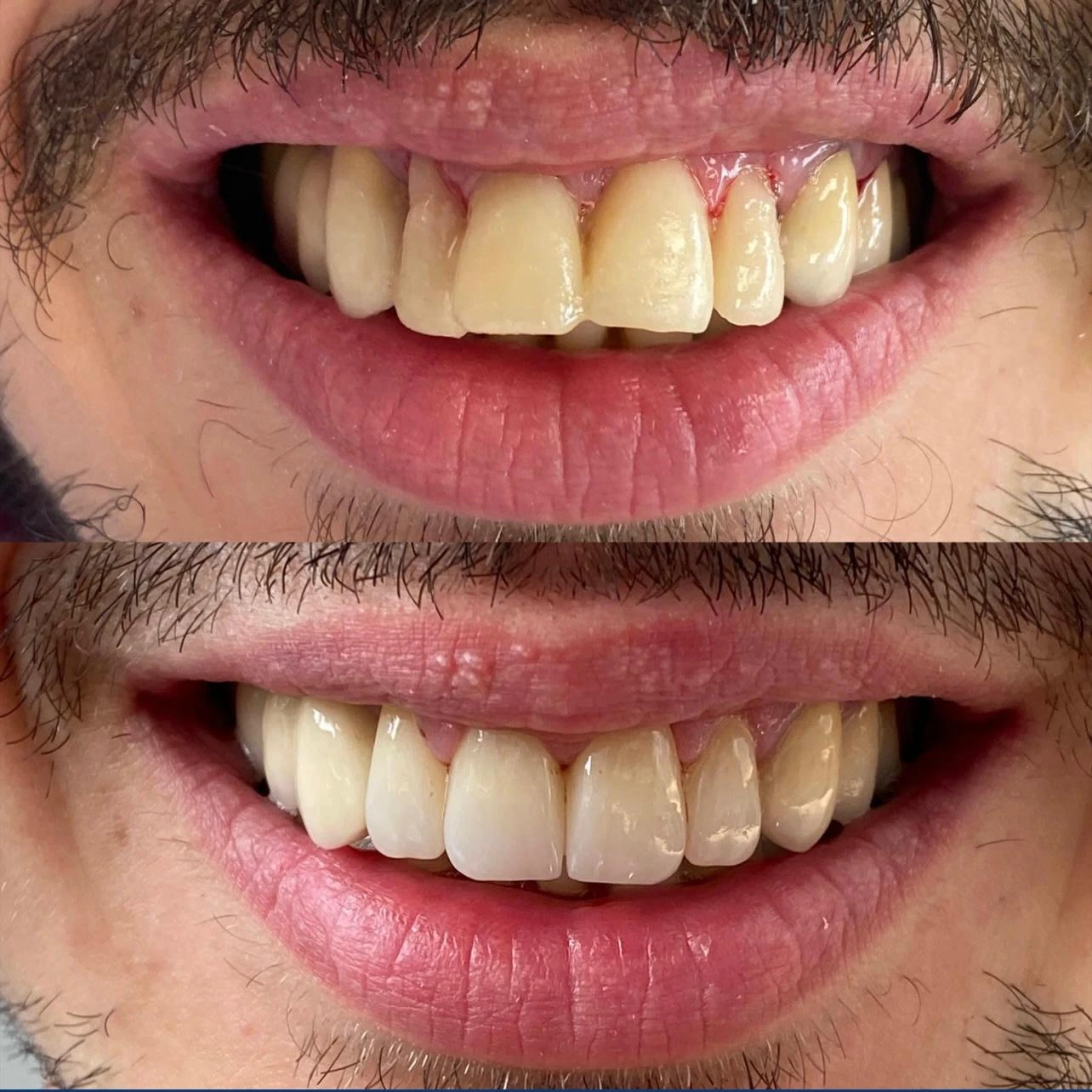Caz clinic Sherman Dent — imaginea 9
